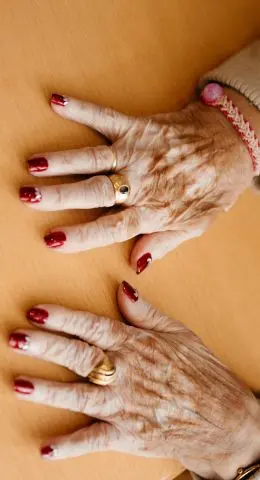 Residencia Santo Hospital Tafalla